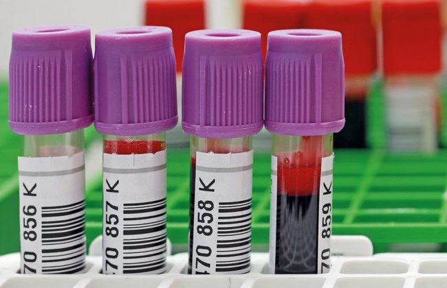 Blood samples for nucleic acid extraction