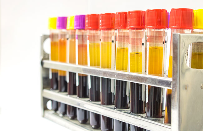 Medium volume cfDNA purification from plasma