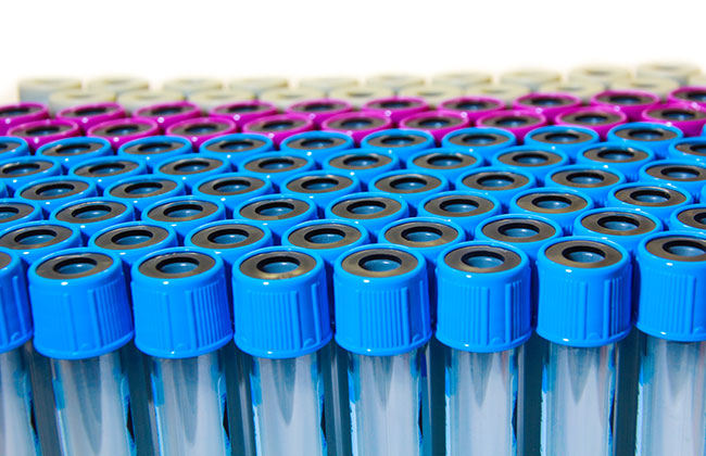 Blood samples ready for high-throughput DNA and RNA purification